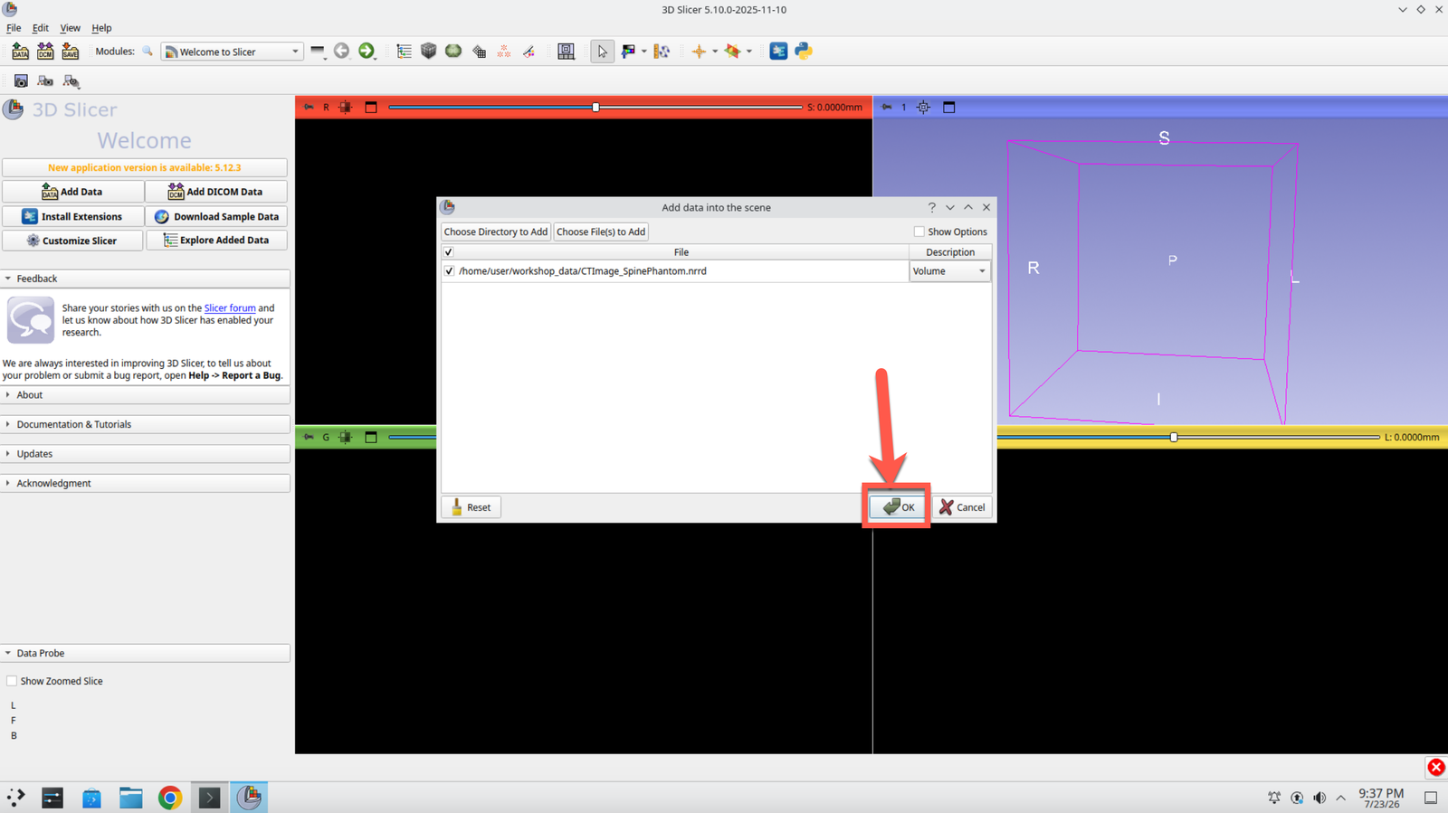 Add Data dialog with the CT image listed and the OK button ready