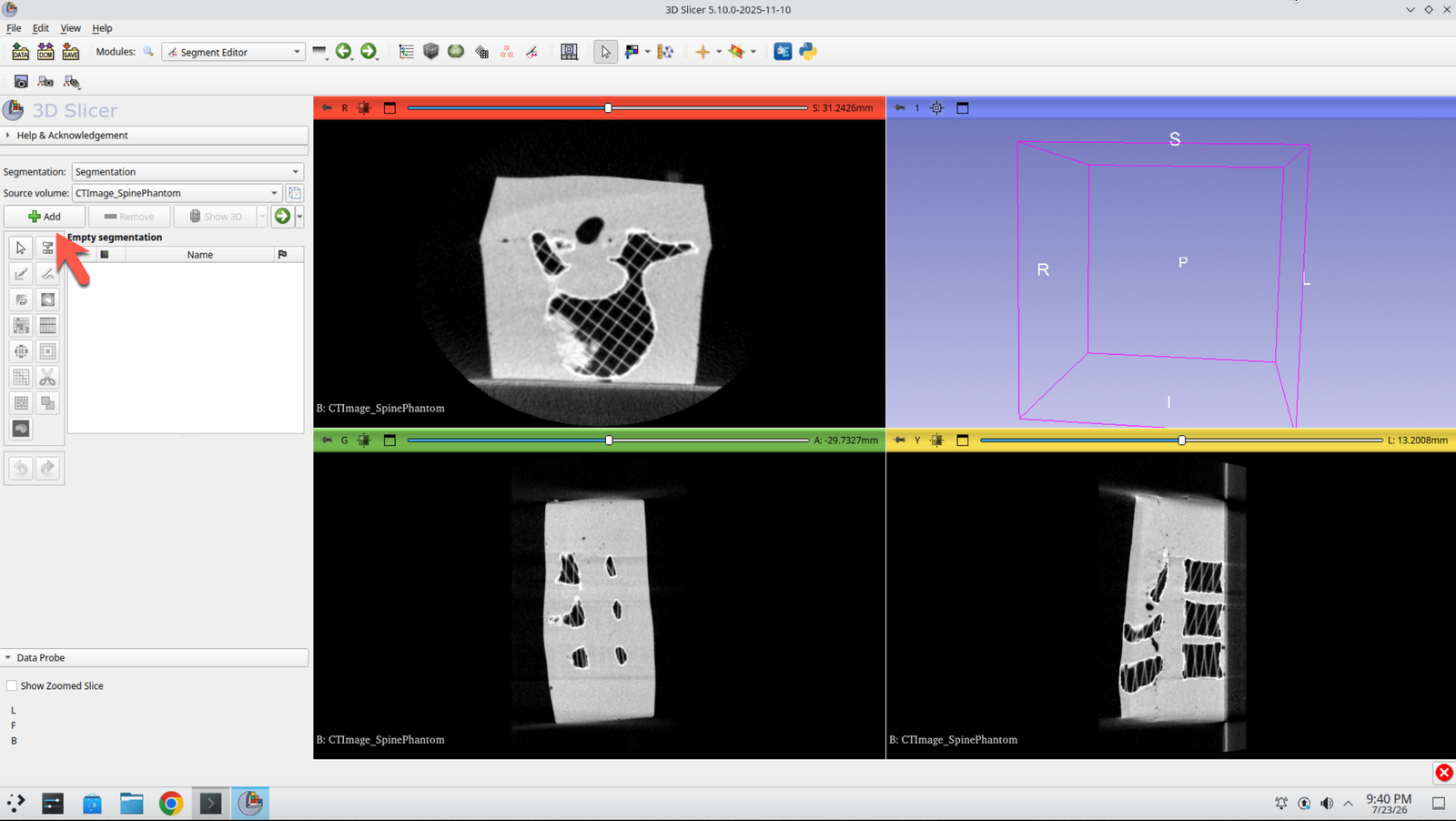 Segment Editor panel showing two newly added segments