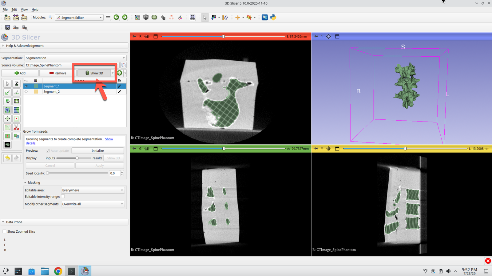 Slicer 3D view showing the segmented spine surface model
