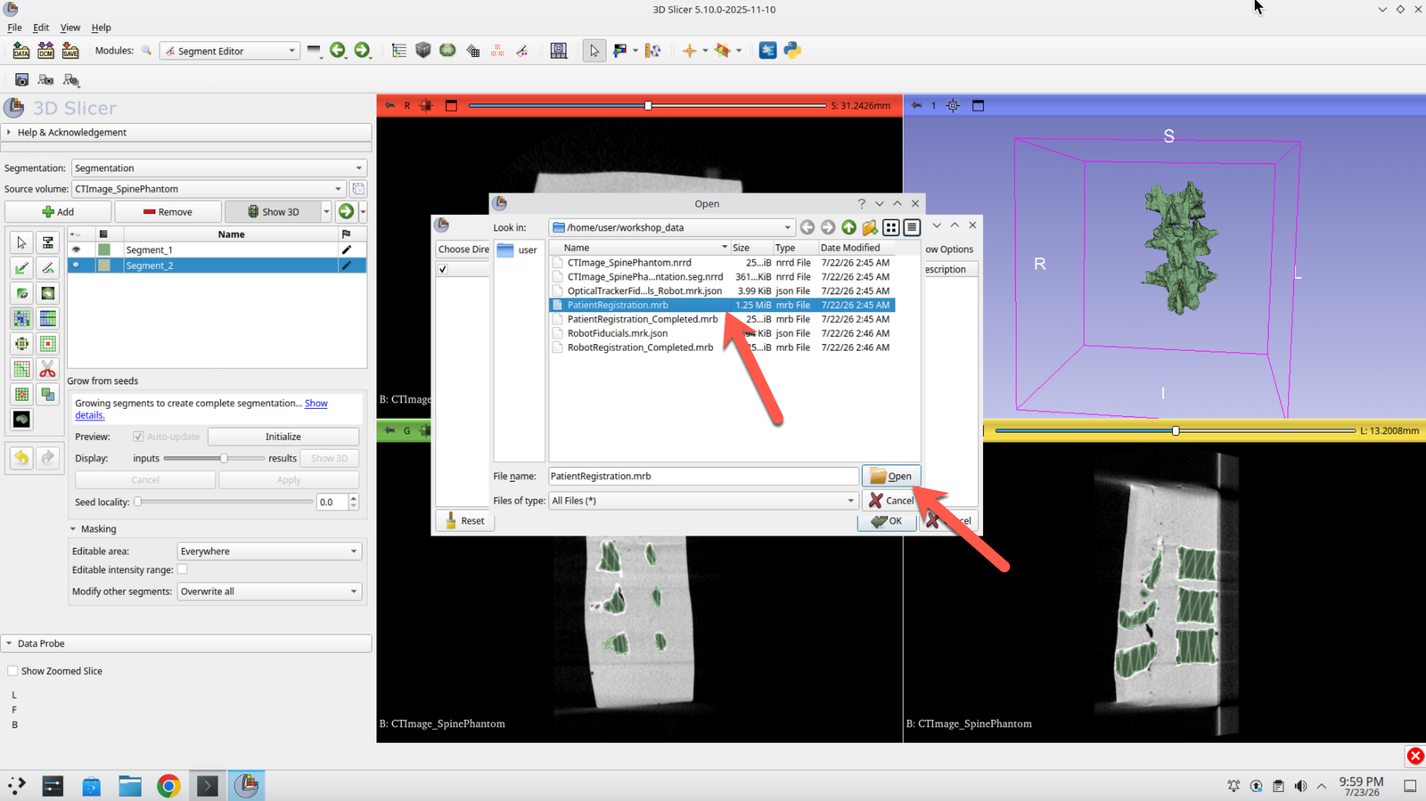 File dialog with PatientRegistration.mrb selected