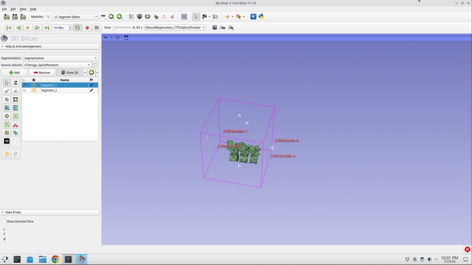 Slicer 3D view showing the spine model with four fiducial points at the gel block corners