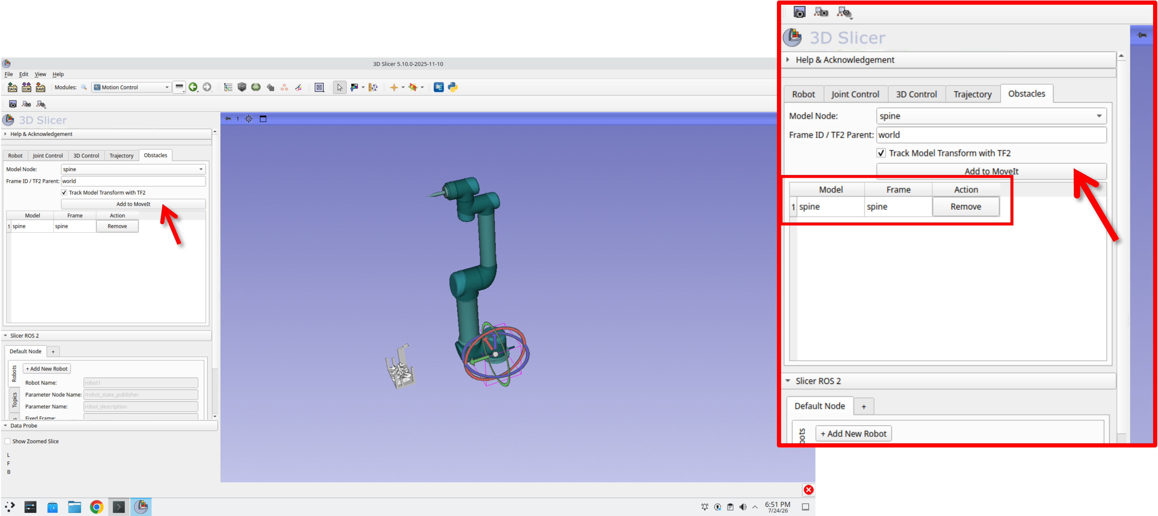Obstacles tab showing the spine model added to the obstacle table, with planning handles visible in the 3D view