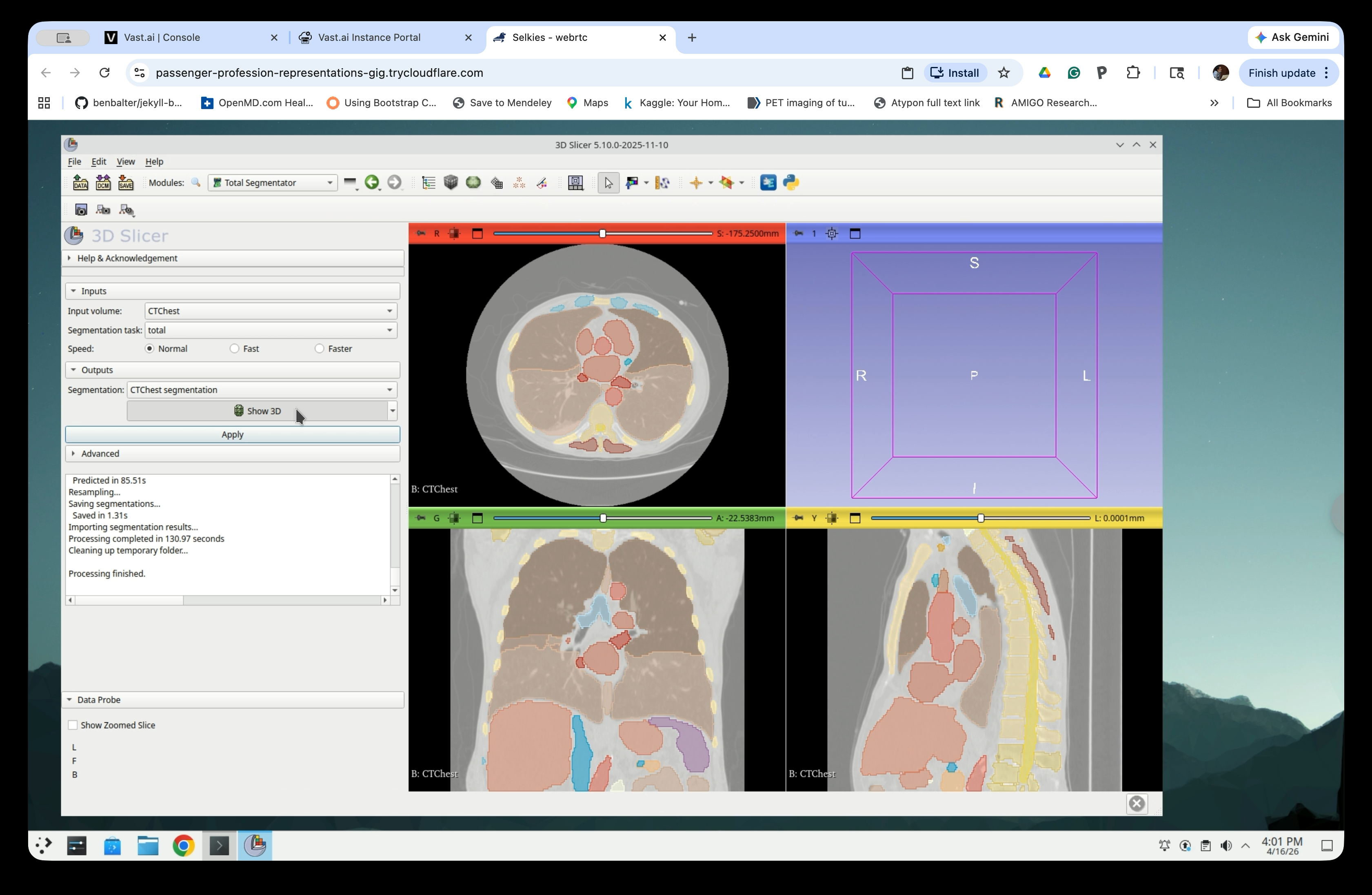 Show 3D checkbox visible in TotalSegmentator panel