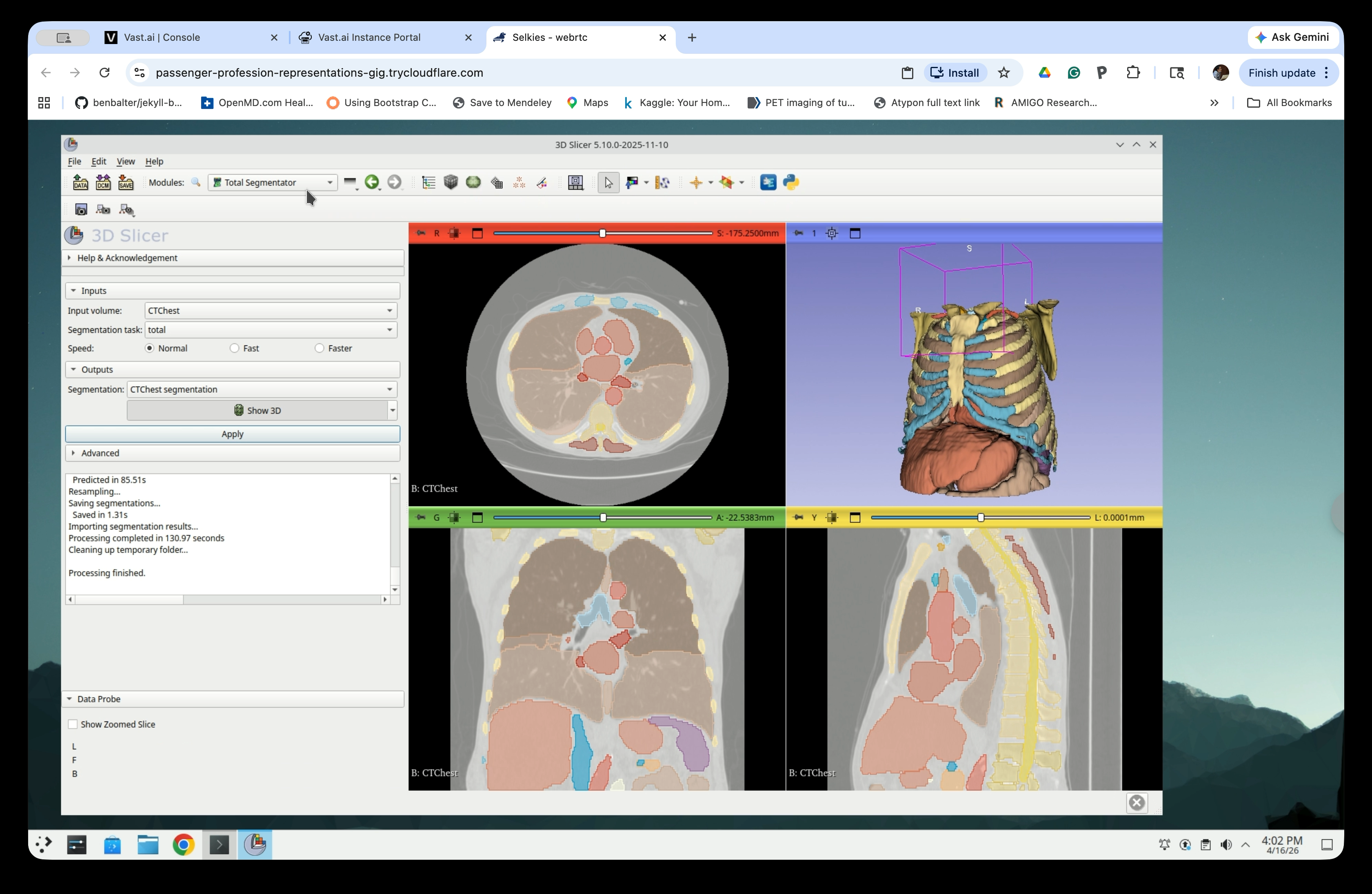 3D view showing segmented chest anatomy