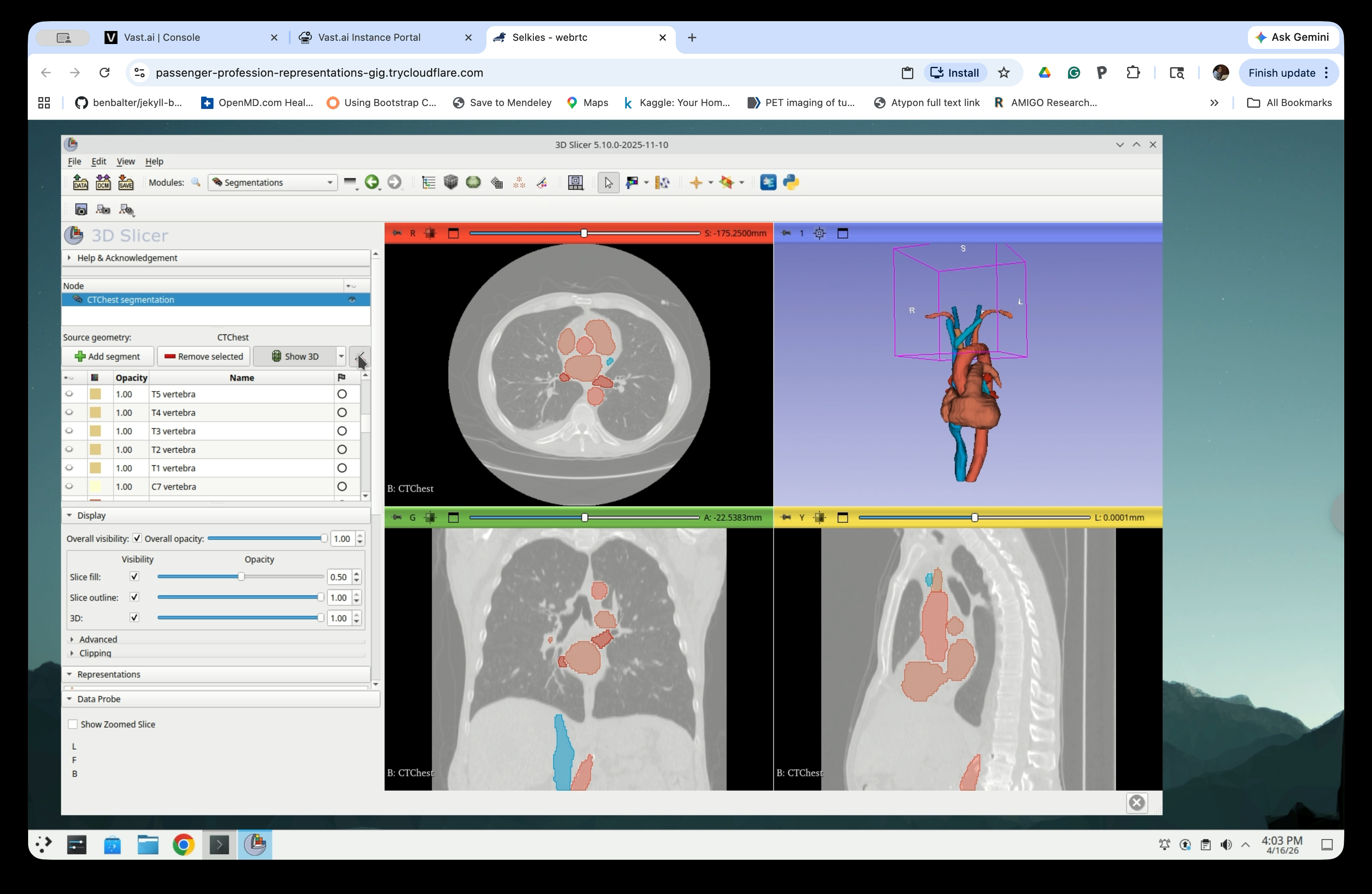 Modules menu navigating to Segment Editor