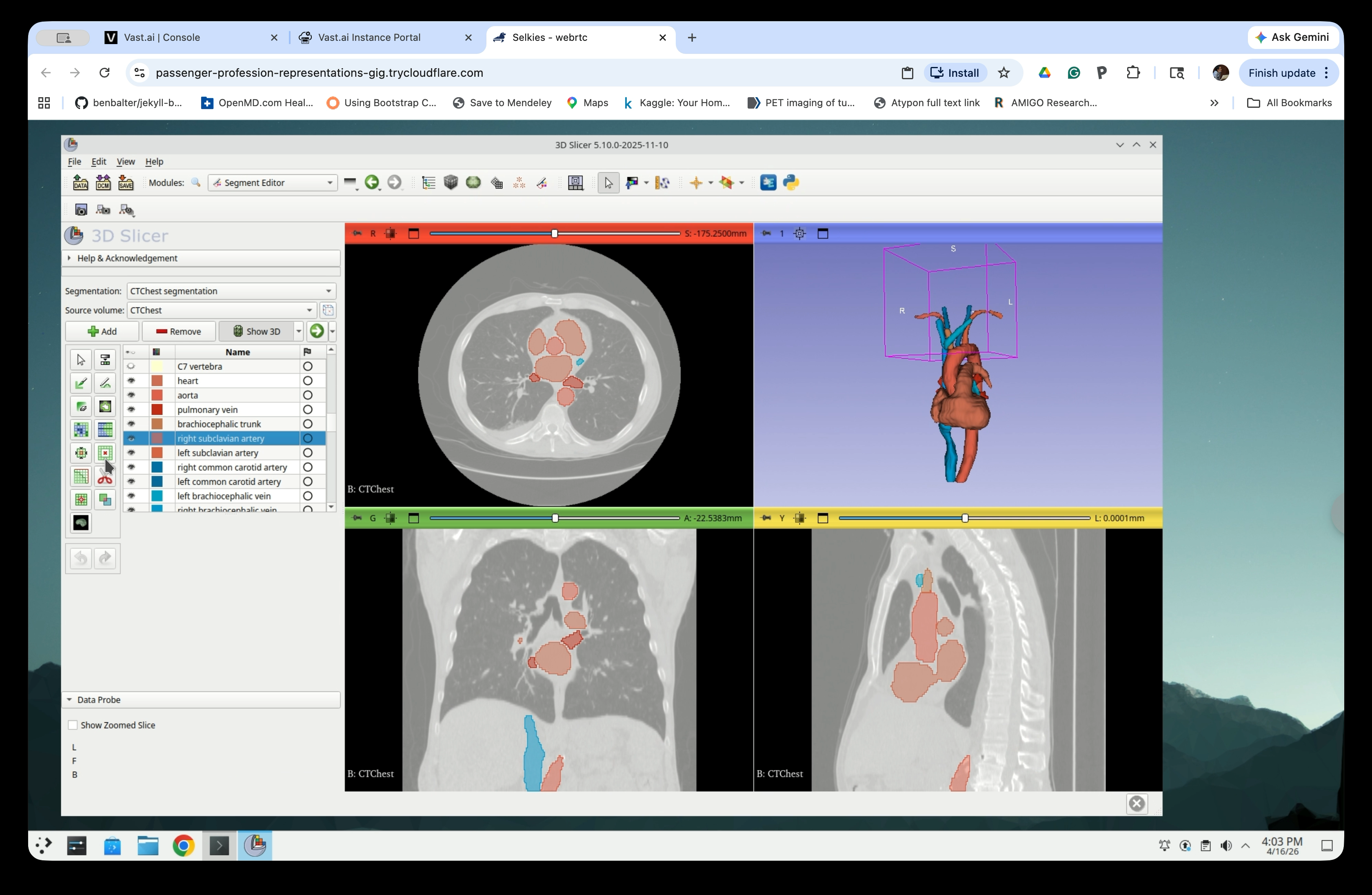 Segment Editor with heart selected and Hollow effect panel open
