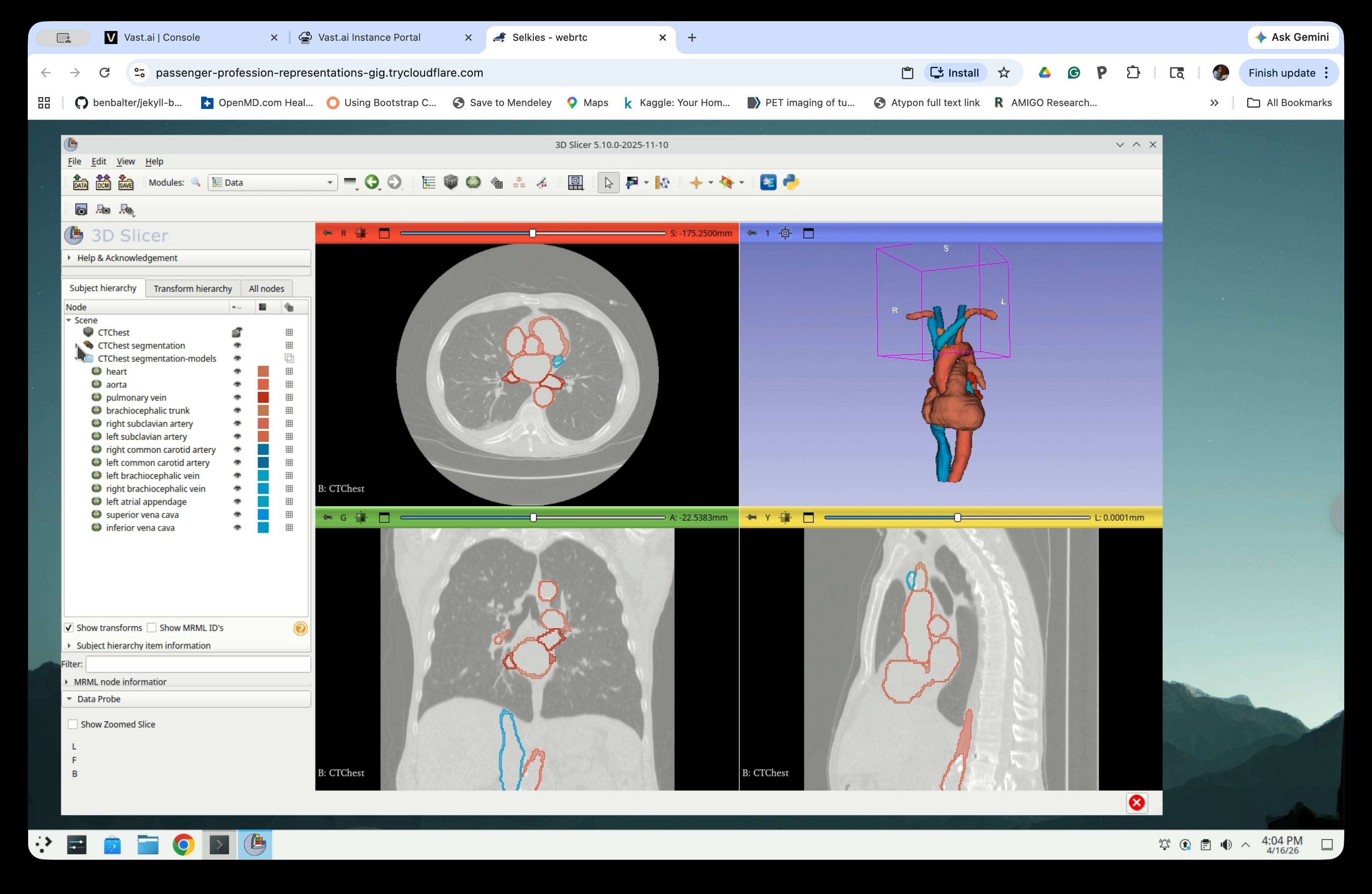 Scene tree with CTChest segmentation-models folder expanded showing individual model nodes