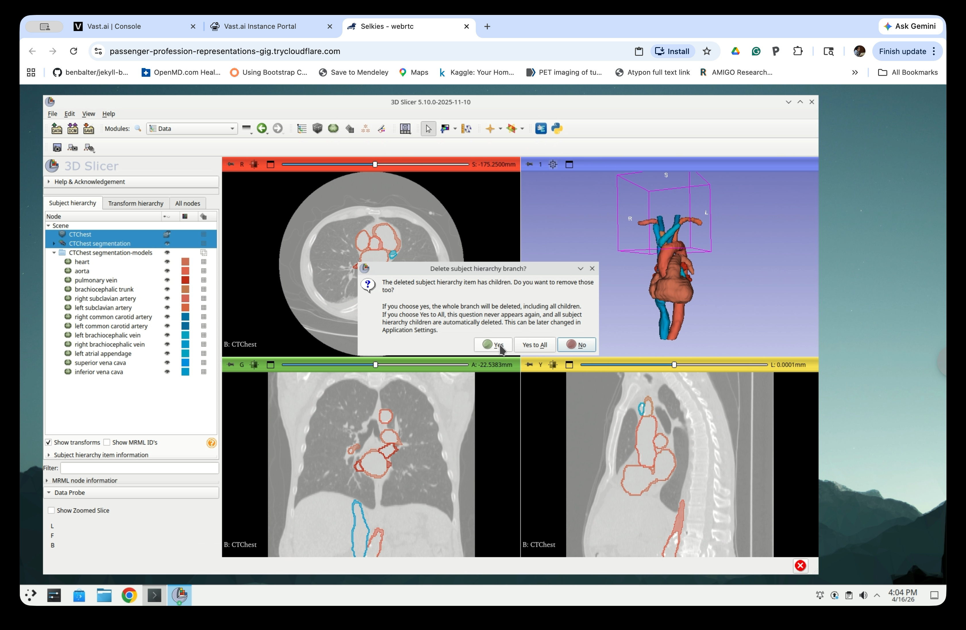 Delete subject hierarchy branch confirmation dialog
