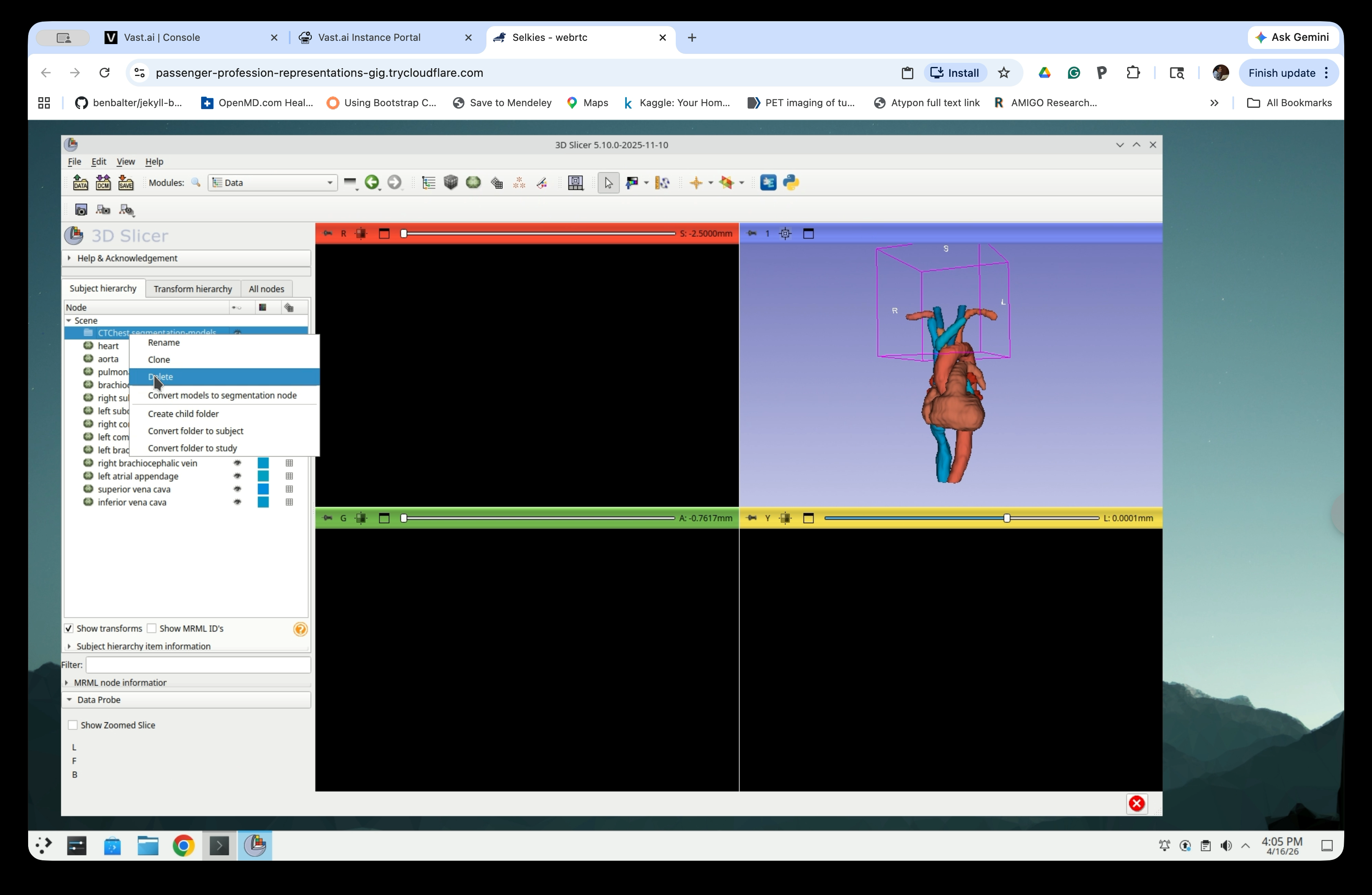 Right-click context menu on the empty folder showing Delete option