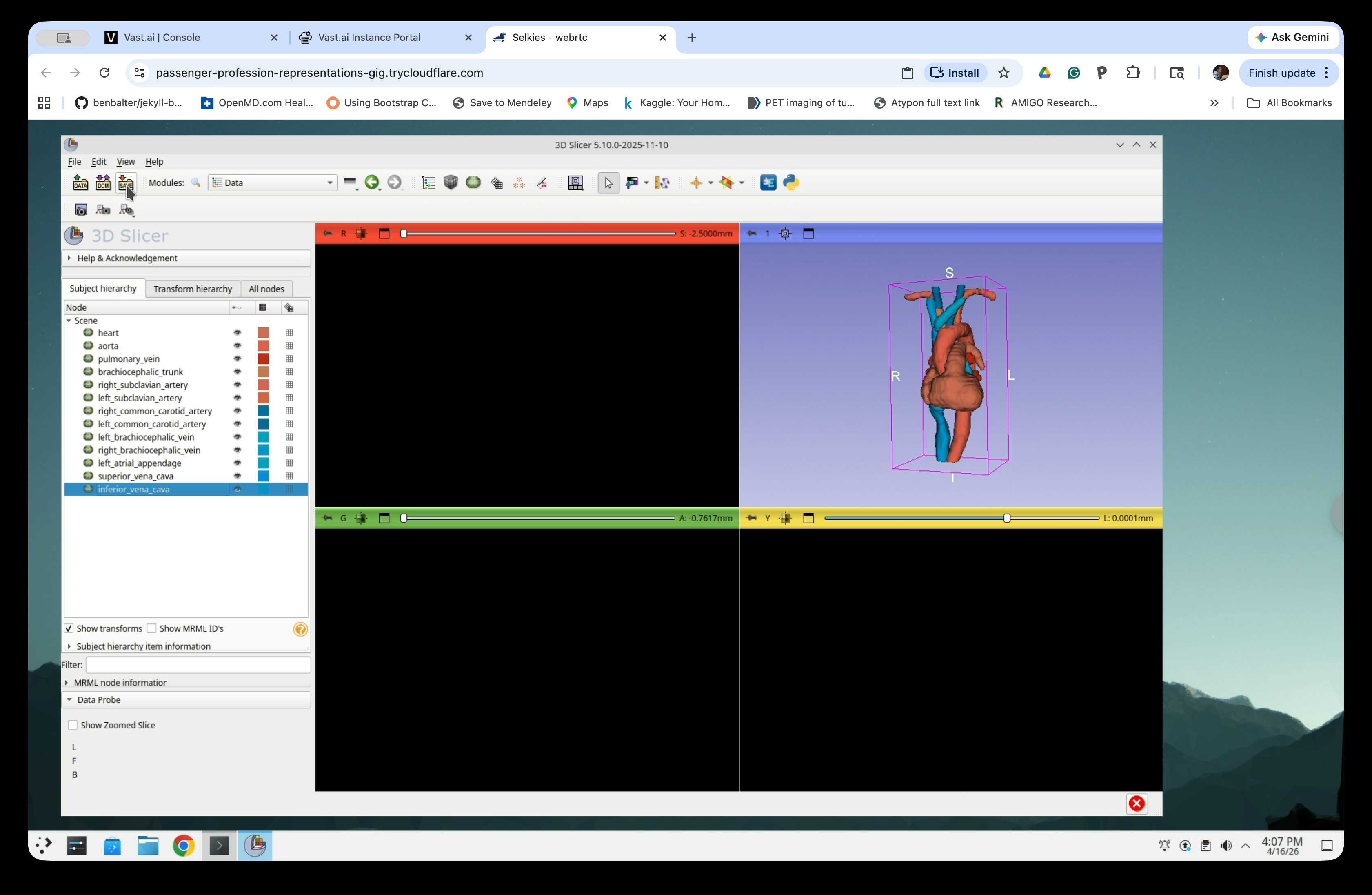 Scene tree with all models renamed and 3D view showing the complete vascular model