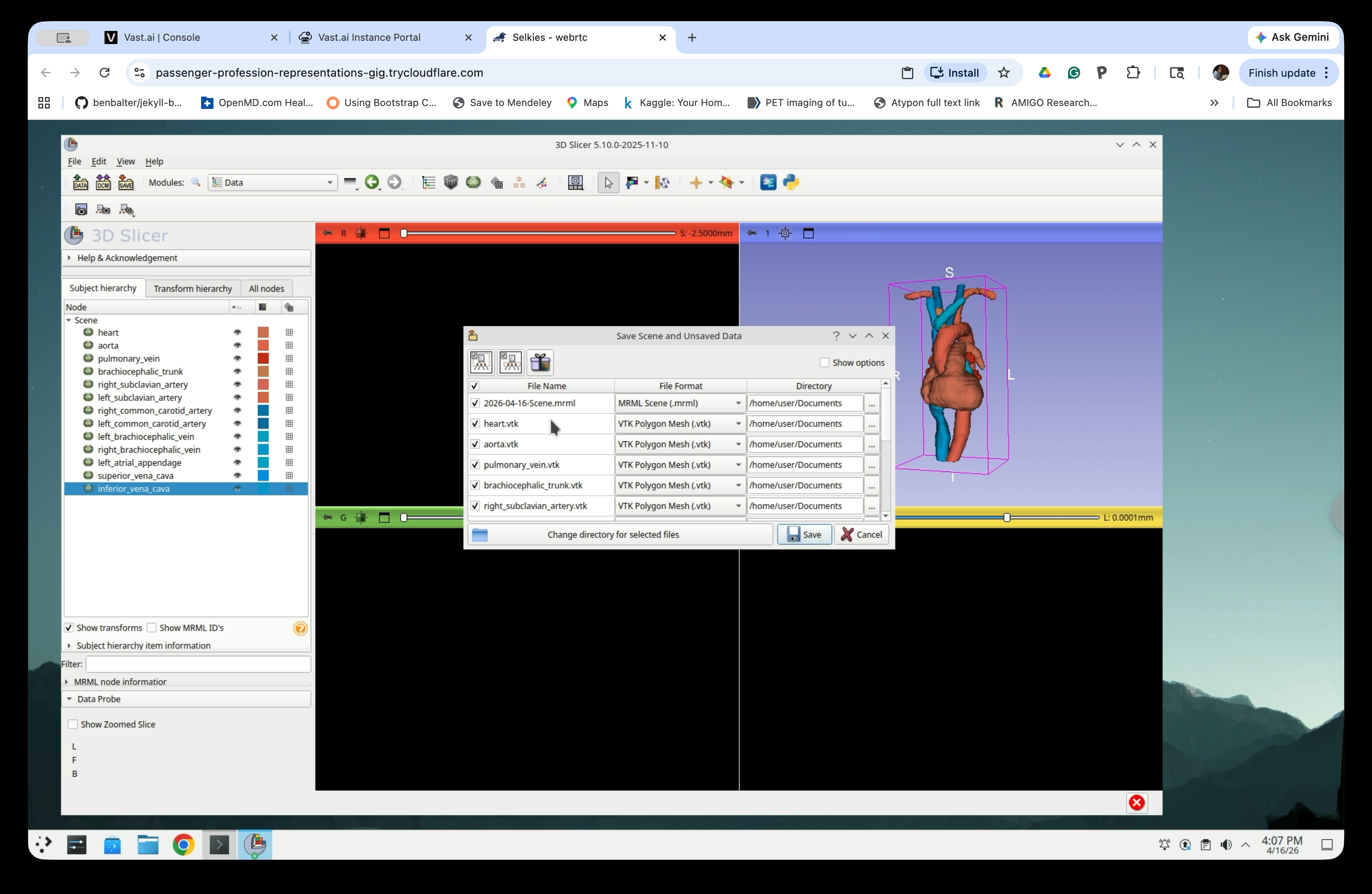 Save Scene and Unsaved Data dialog showing model files in VTK format