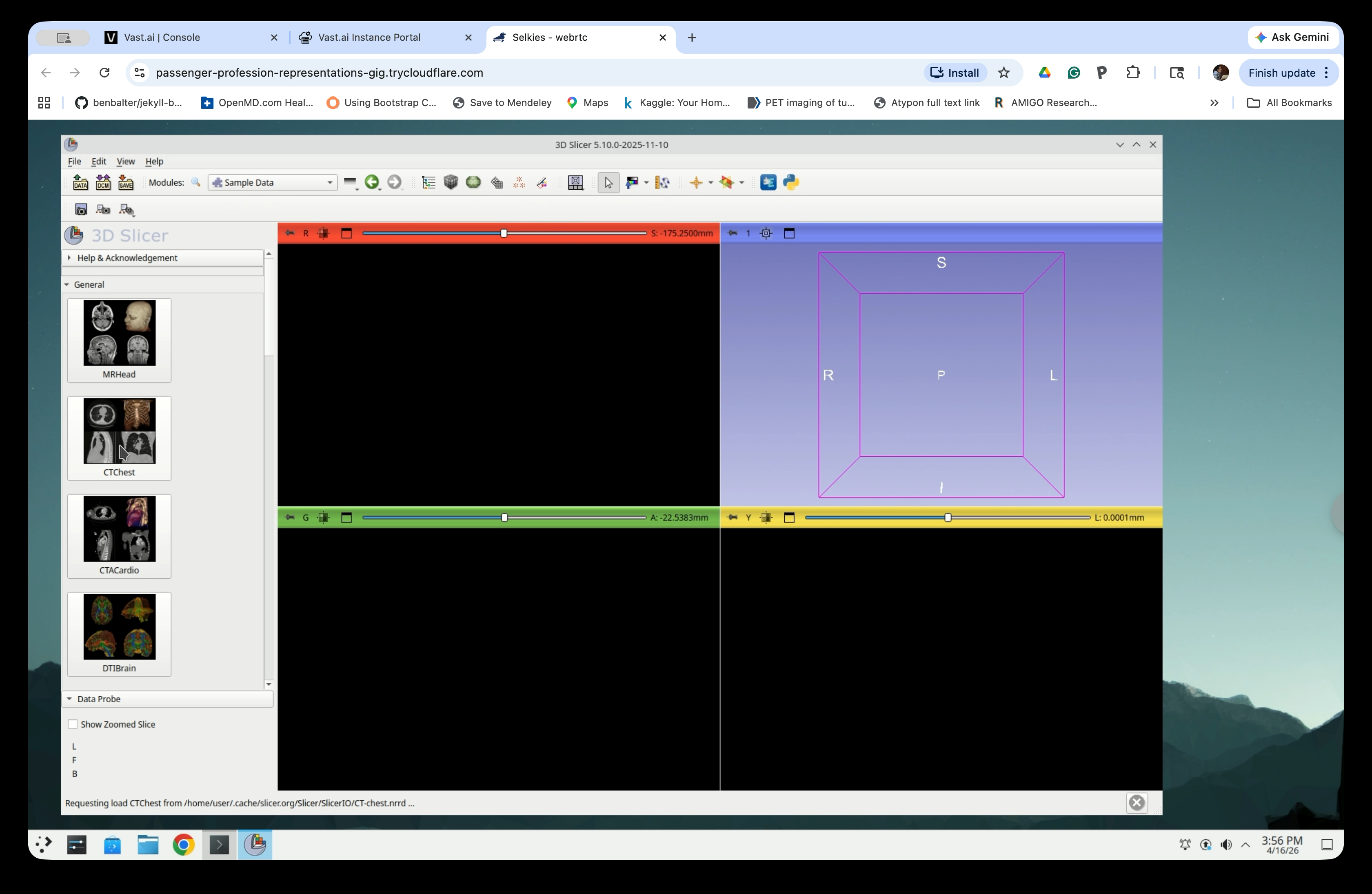 Sample Data panel with CTChest highlighted
