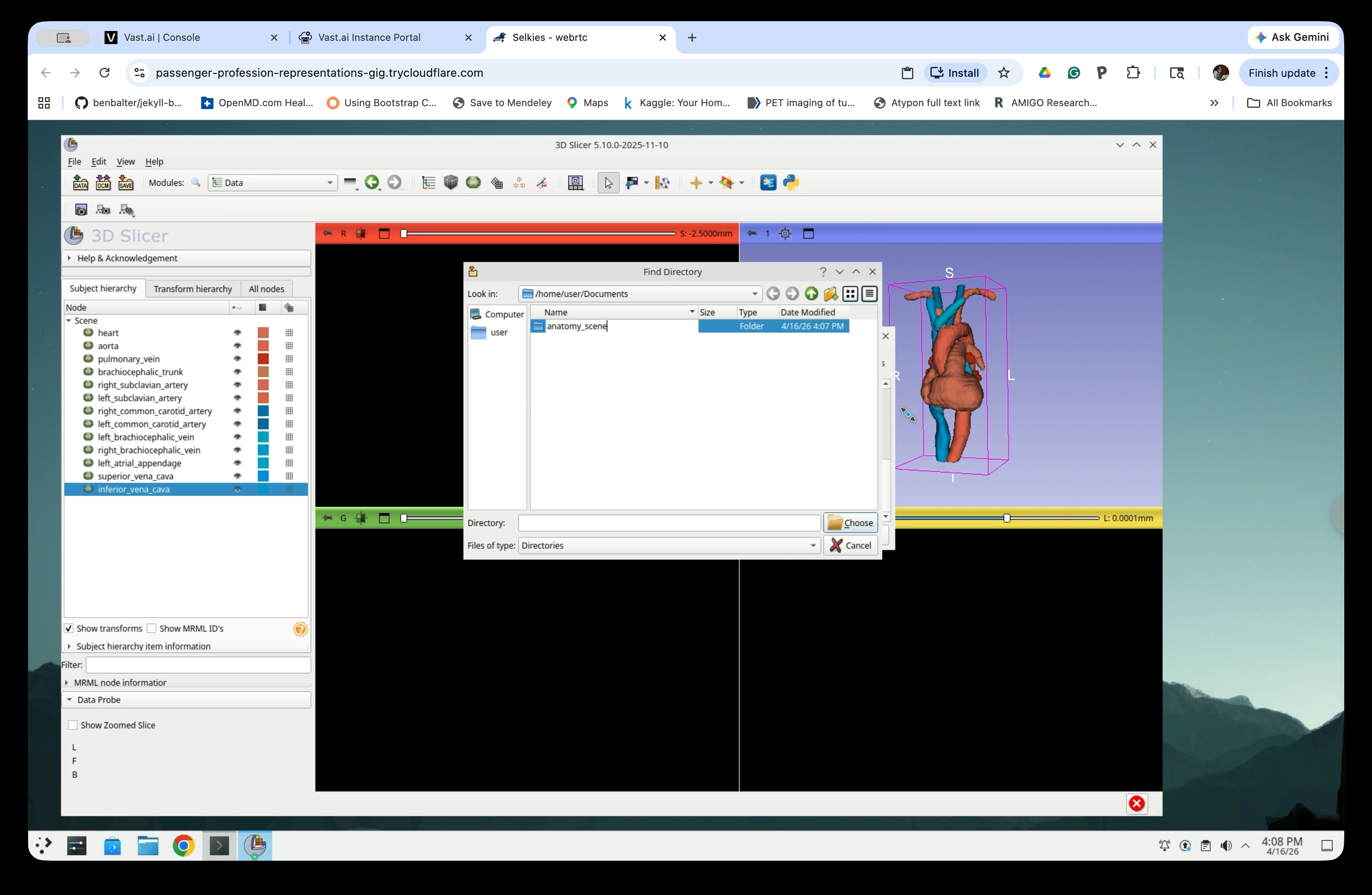 anatomy_scene folder shown in the Find Directory dialog