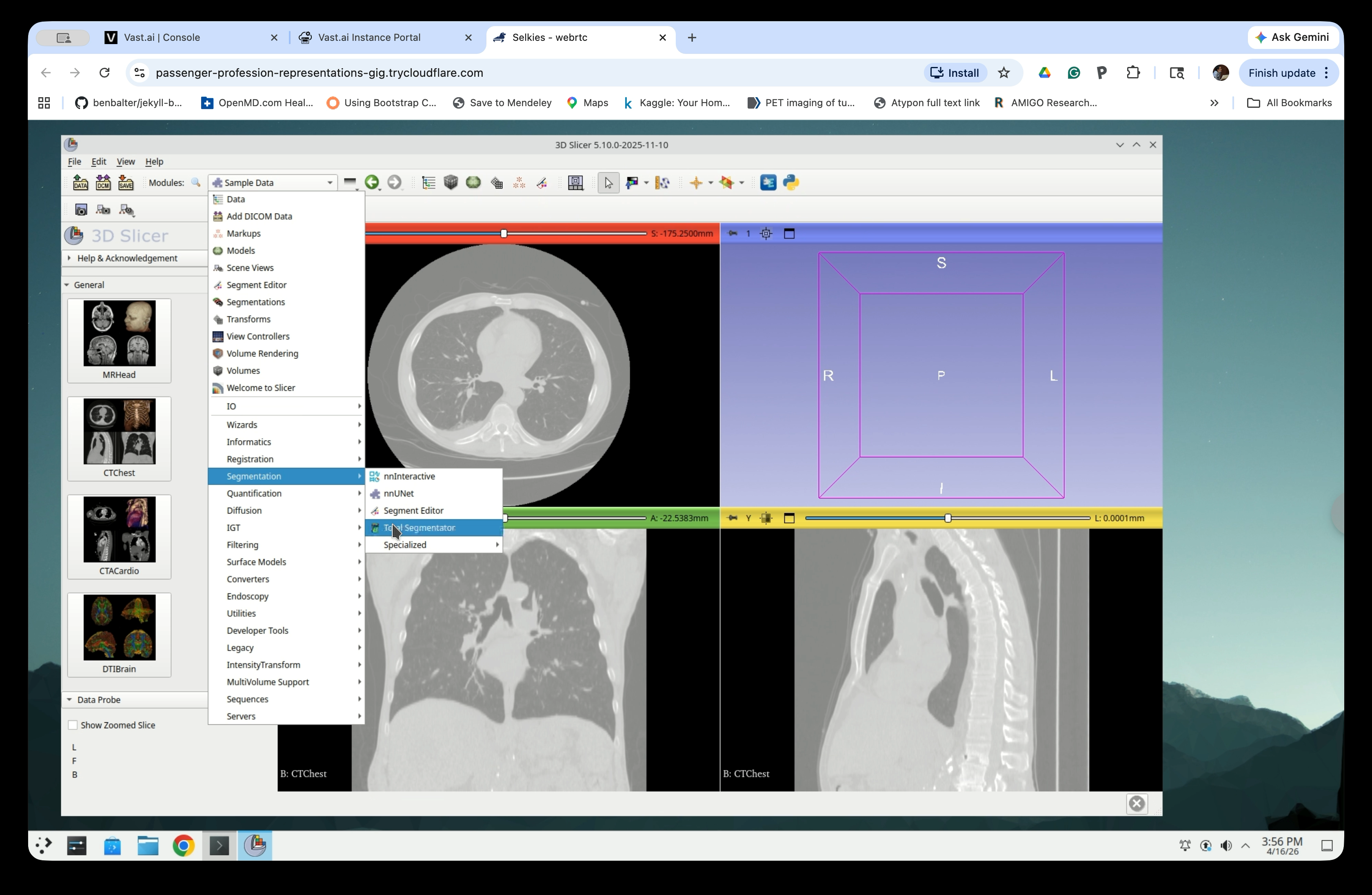 Modules menu with TotalSegmentator highlighted under Segmentation