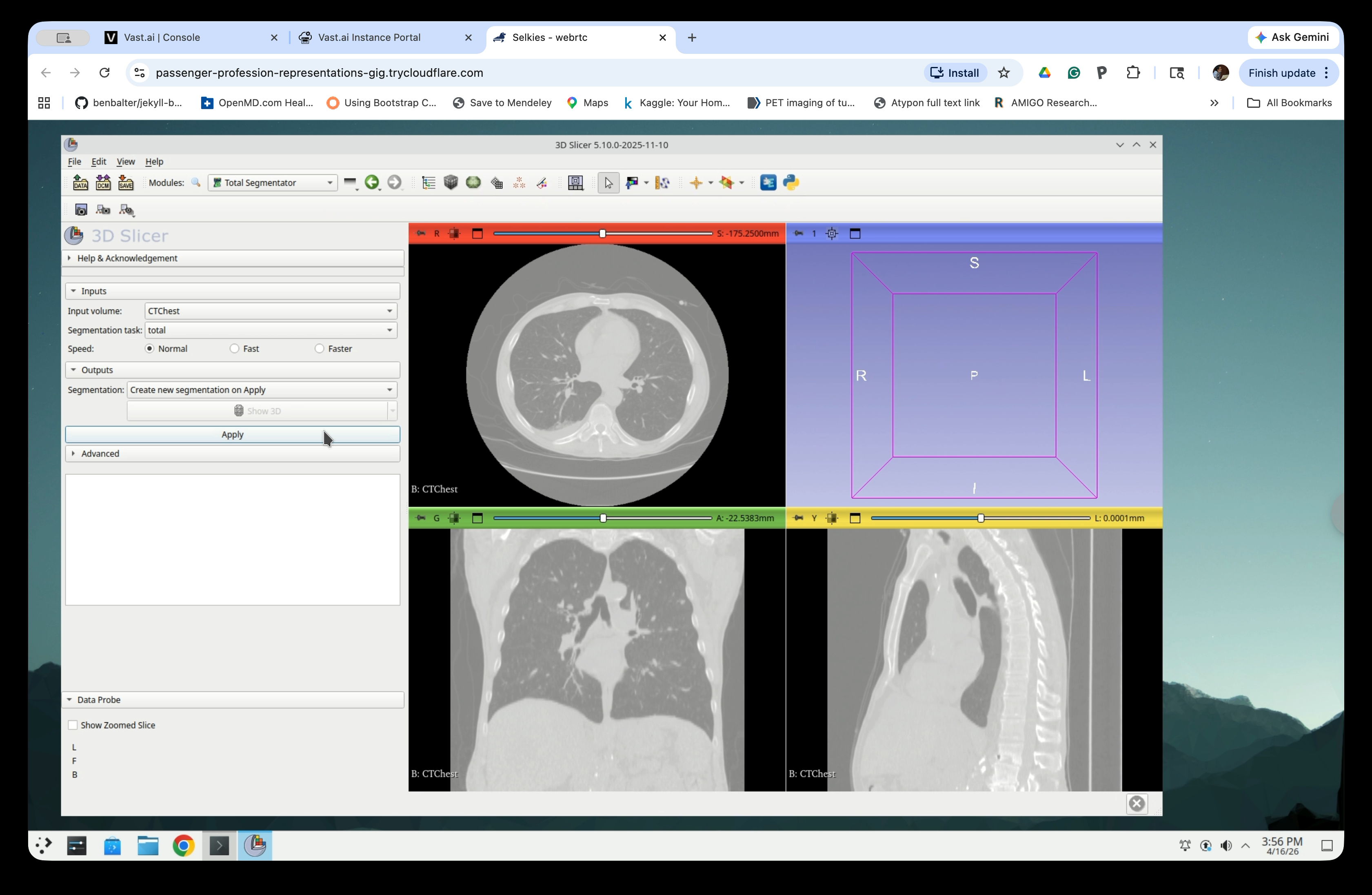 TotalSegmentator panel with settings configured and Apply button