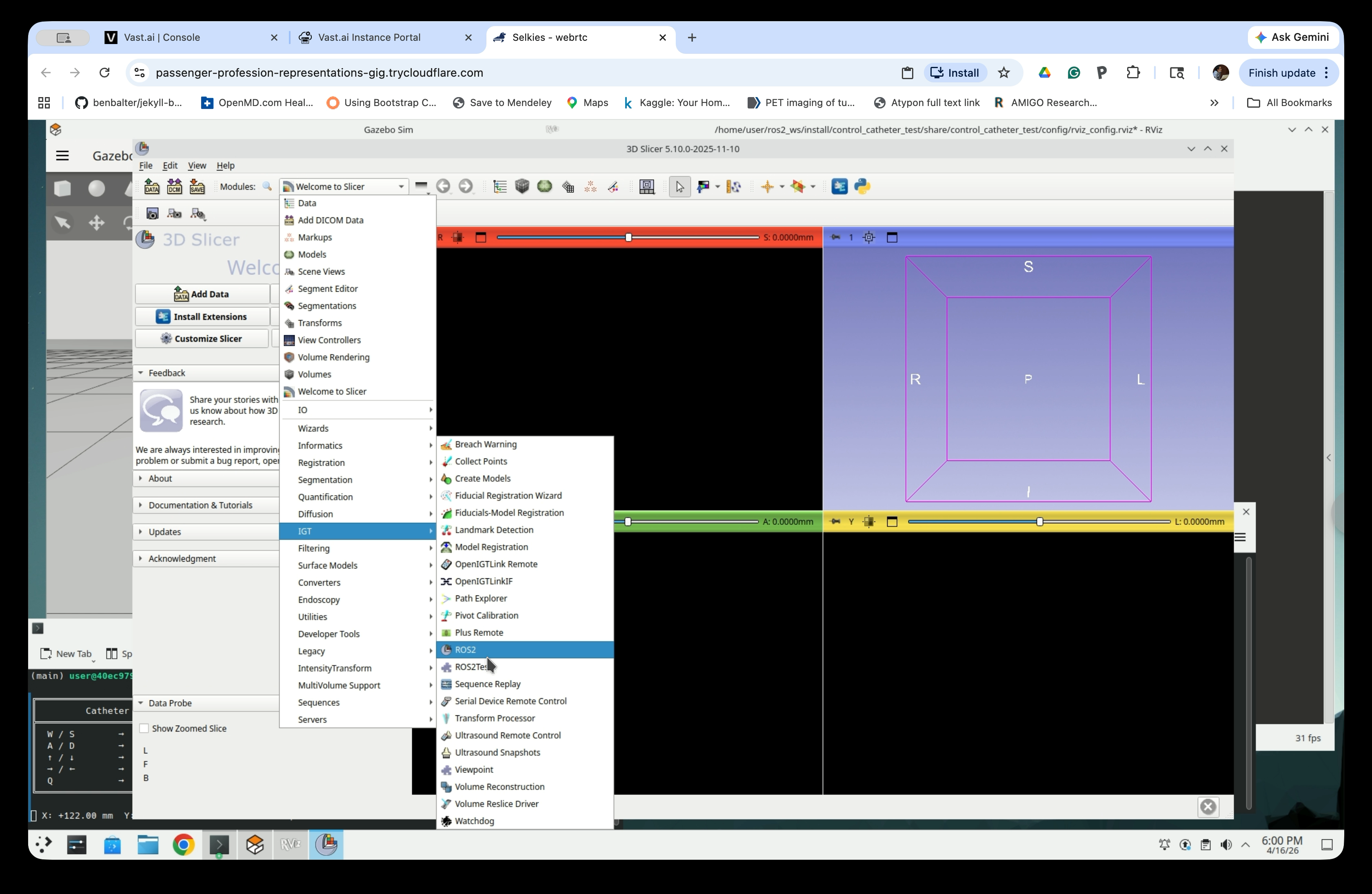 Slicer Modules menu with ROS2 highlighted under IGT