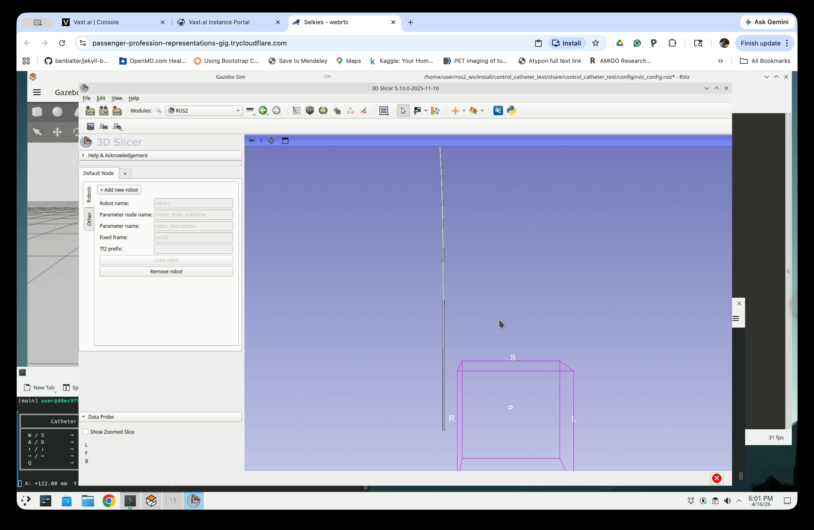Slicer 3D only view showing the catheter model