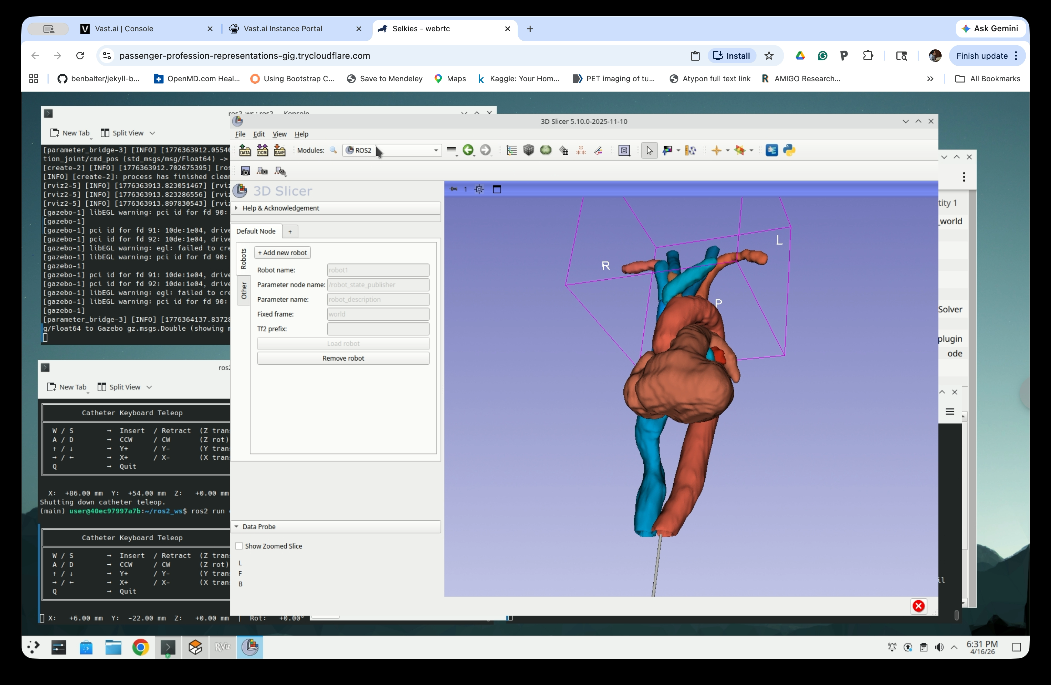 Slicer 3D view showing heart and vessels with catheter entering from below at a good viewing angle