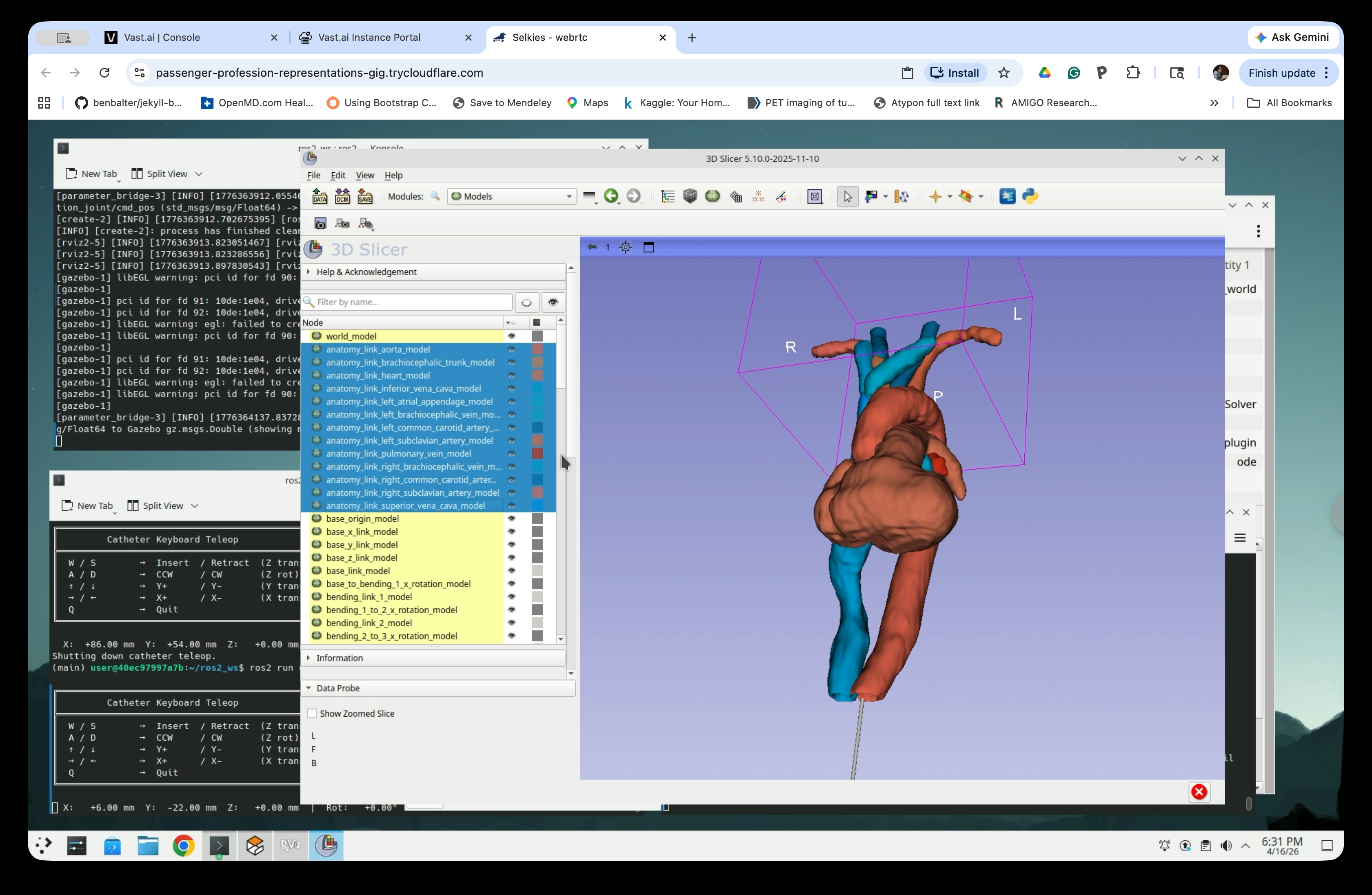 Models module showing the full list of anatomy and catheter model nodes
