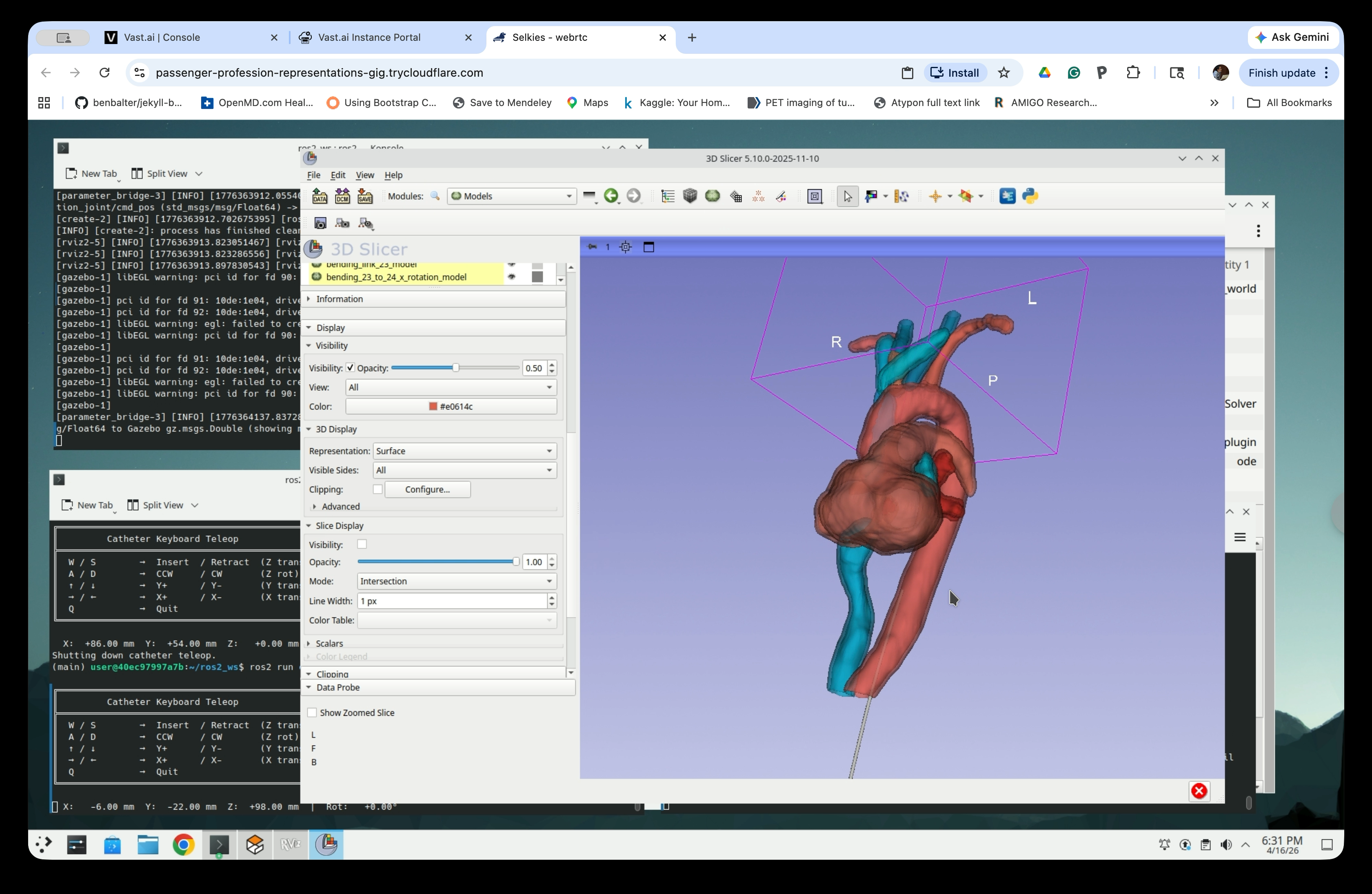 Slicer 3D view showing catheter inserted into the anatomy with teleop terminal visible