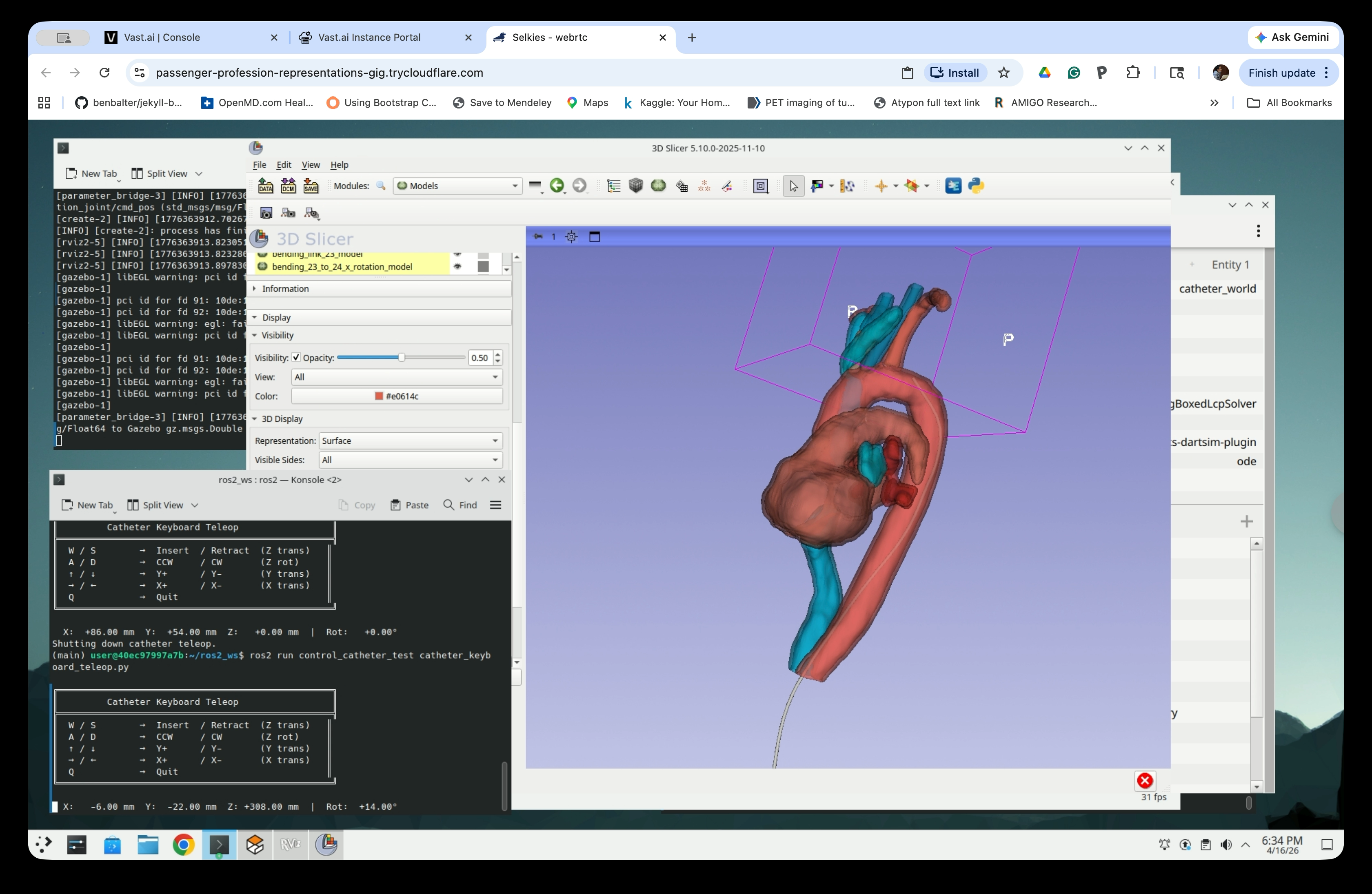 Slicer 3D view showing catheter advanced further into the anatomy from a different angle