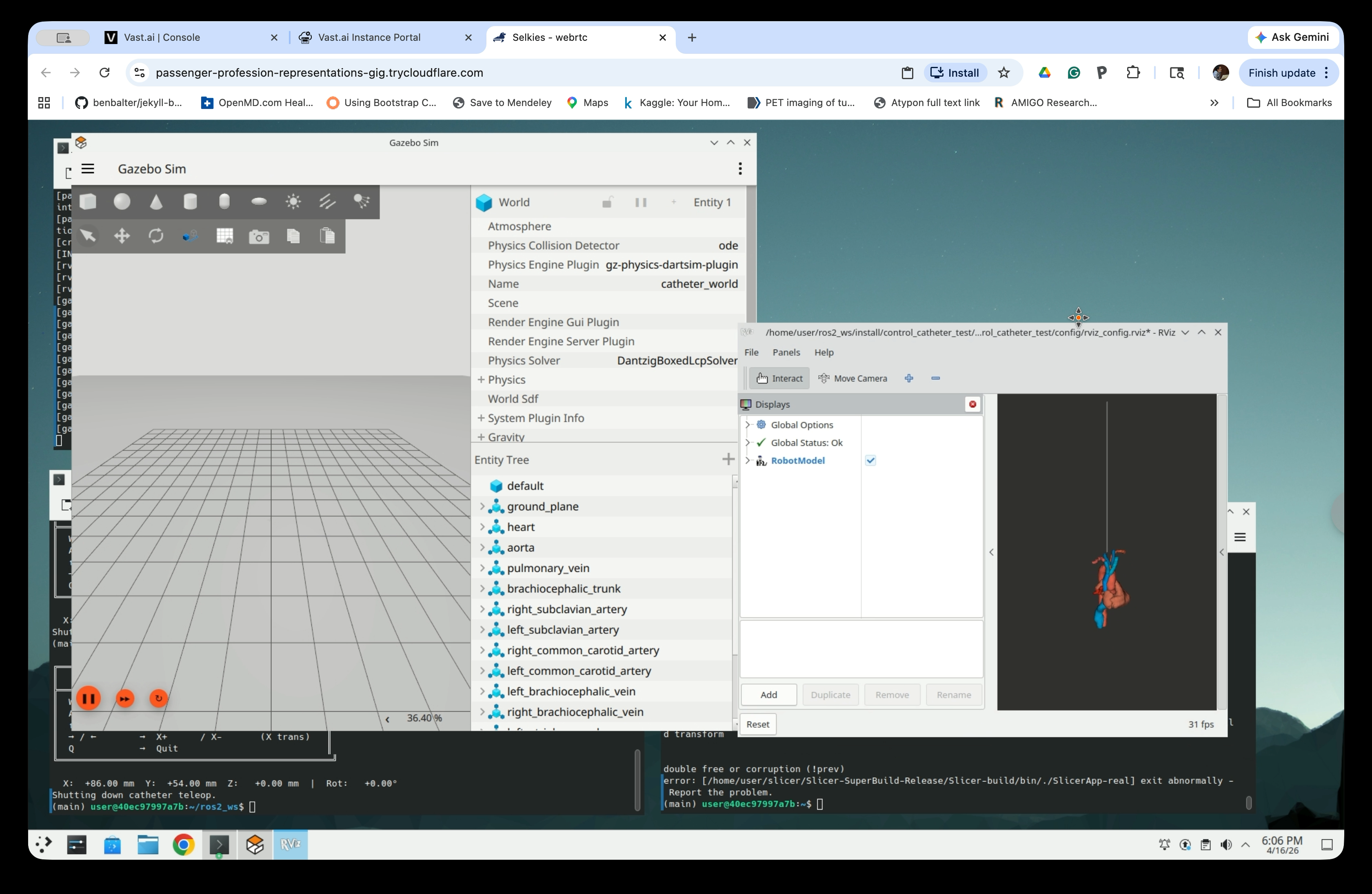 Gazebo entity tree showing anatomy bodies and RViz showing 3D anatomy with catheter