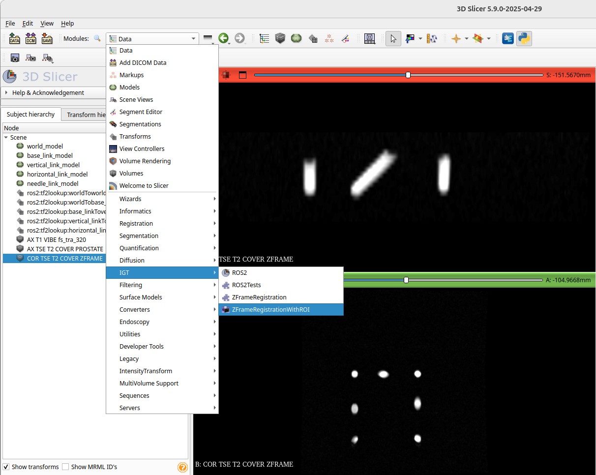ZFrameRegistrationWithROI module